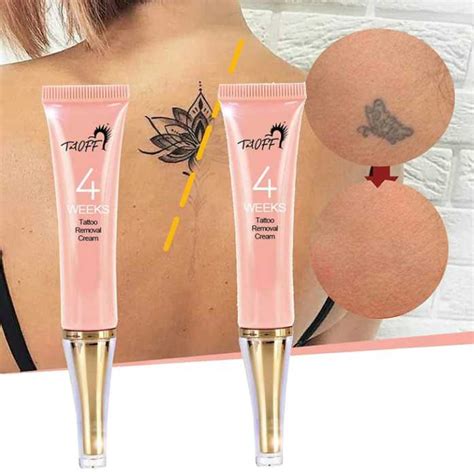 Tattoo removal cream reviews