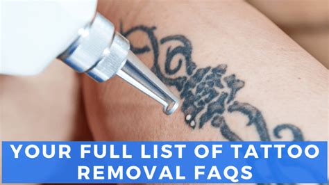 Tattoo removal FAQ