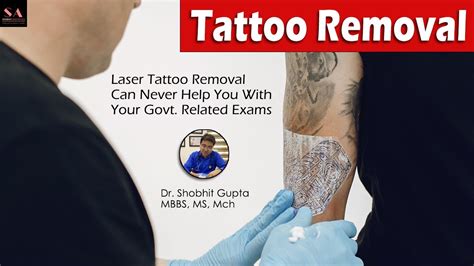 Tattoo Removal in Military