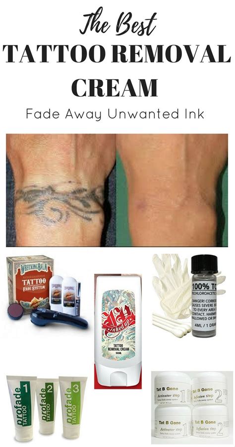 Tattoo removal product reviews