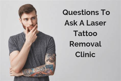 Tattoo removal questions