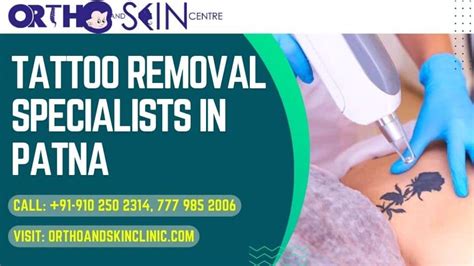 Tattoo removal specialist