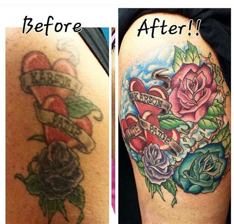 Tattoo removal Wichita KS