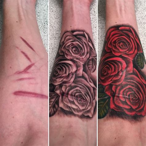 Tattoo scar cover-up example