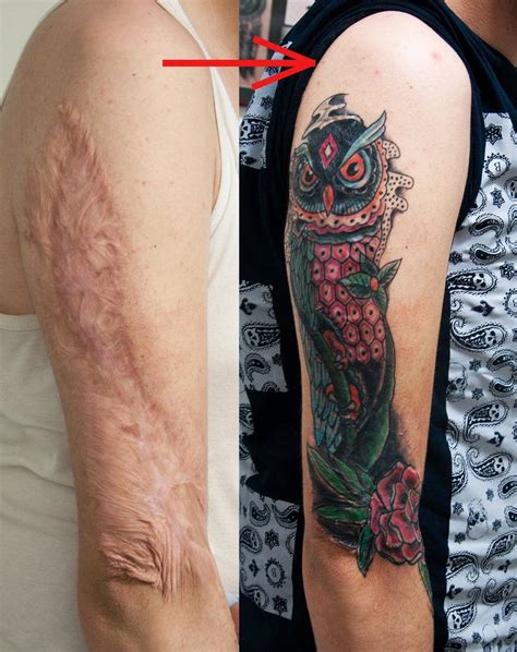 Tattoo scar healing process