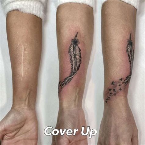 Tattooing over scars benefits and risks