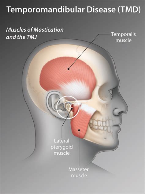 Description of TMJ Disorder