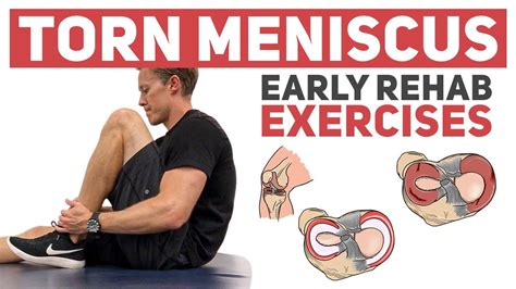 Torn Meniscus Rehabilitation Exercises