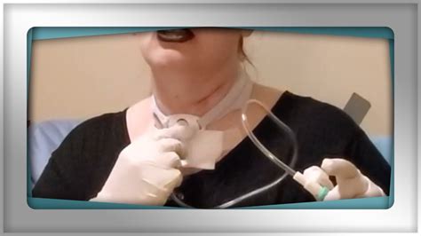 Tracheostomy suctioning challenges