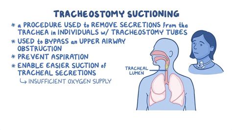 Tracheostomy suctioning steps