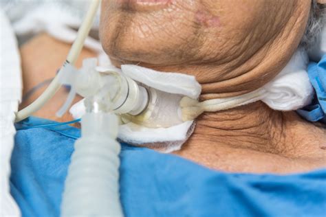 Tracheostomy tube care