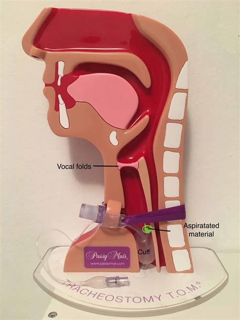 Tracheostomy tube education