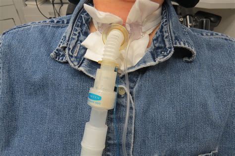 Tracheostomy tube support