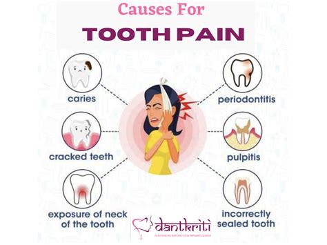 Treating Toothaches and Dental Pain