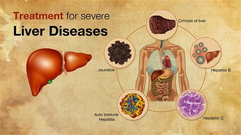 Treatment and management of liver diseases