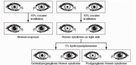 Treatment Options for Horner's Syndrome in Dogs