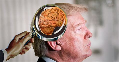 Trump's Mental Health