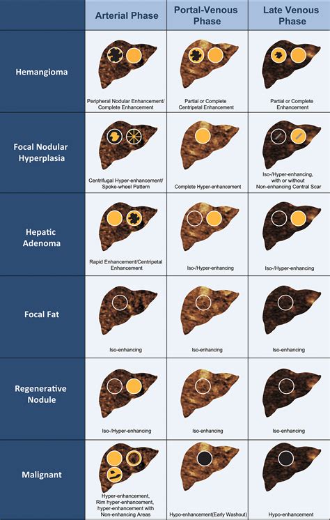 Types of Liver Lesions