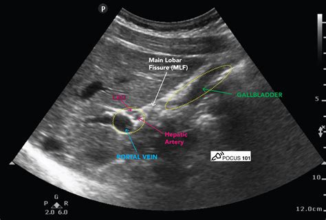 Ultrasound abdomen image