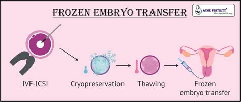 Understanding Frozen Embryo Transfer Process