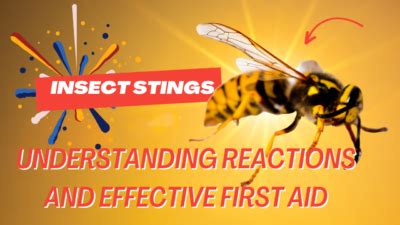 Understanding Insect Stings