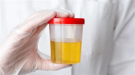 Urine Specimen Collection