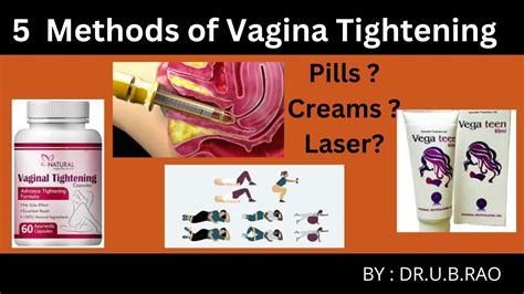 Vagina reference images