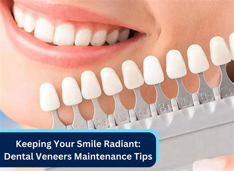 Tips for maintaining veneer