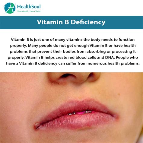 Vitamin B Complex Deficiency