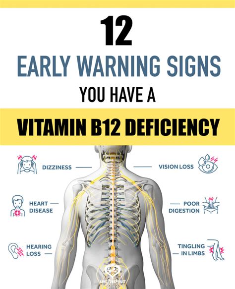 Vitamin B12 deficiency and pain