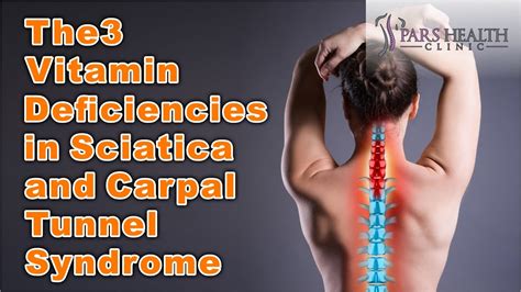 Vitamin B12 Deficiency and Sciatica Pain