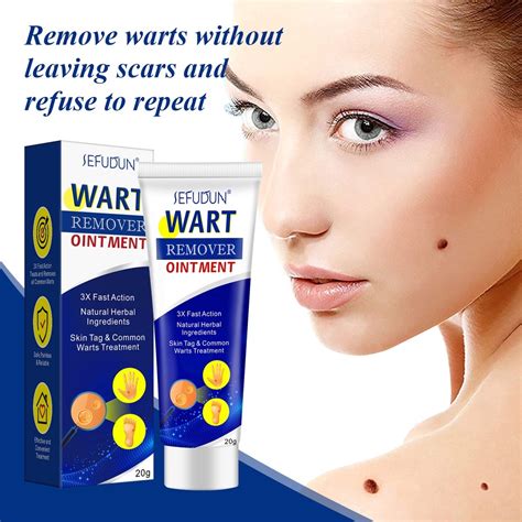 Wart Cure