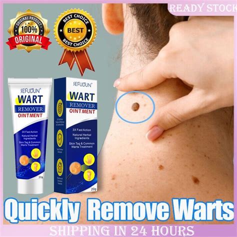 Wart removal benefits