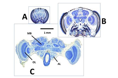 Wasp brain