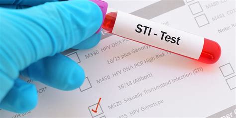 What is an STD Test