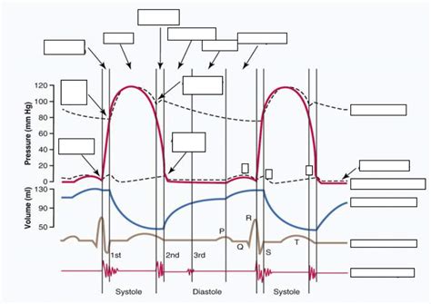 Wiggers Diagram Template for Intensive Care