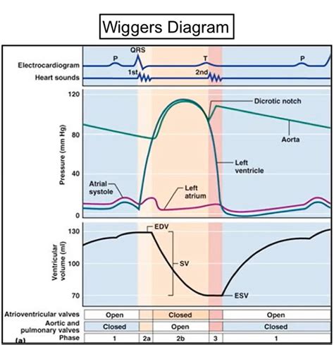 Wiggers Diagram Template for Surgery