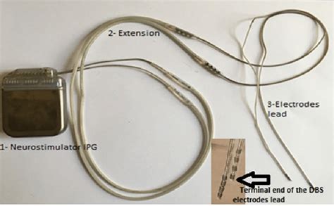 Wire feed and electrode extension