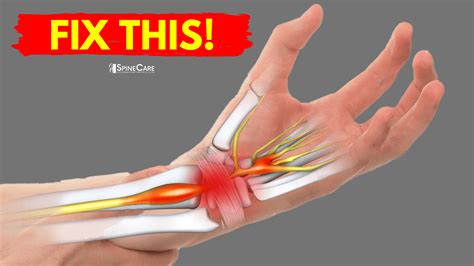 Description of Wrist Pain Relief