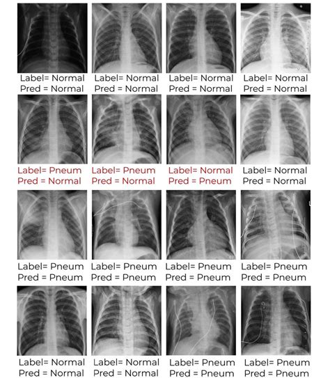 X-ray Results and Follow-up Care